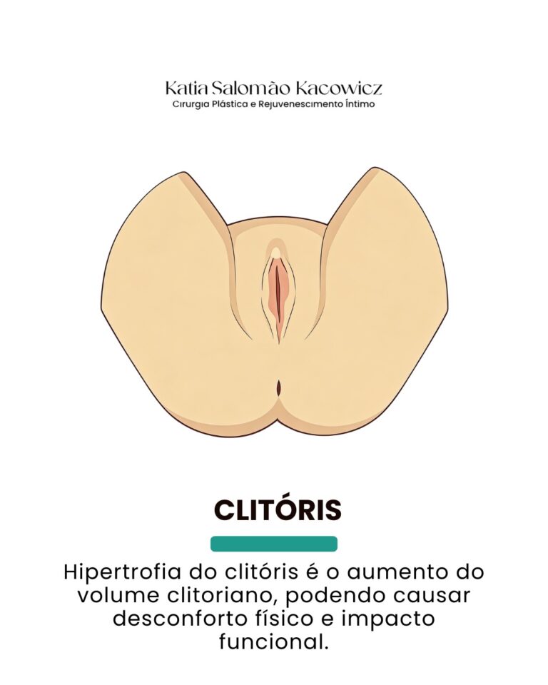 Característica anatômica 2
