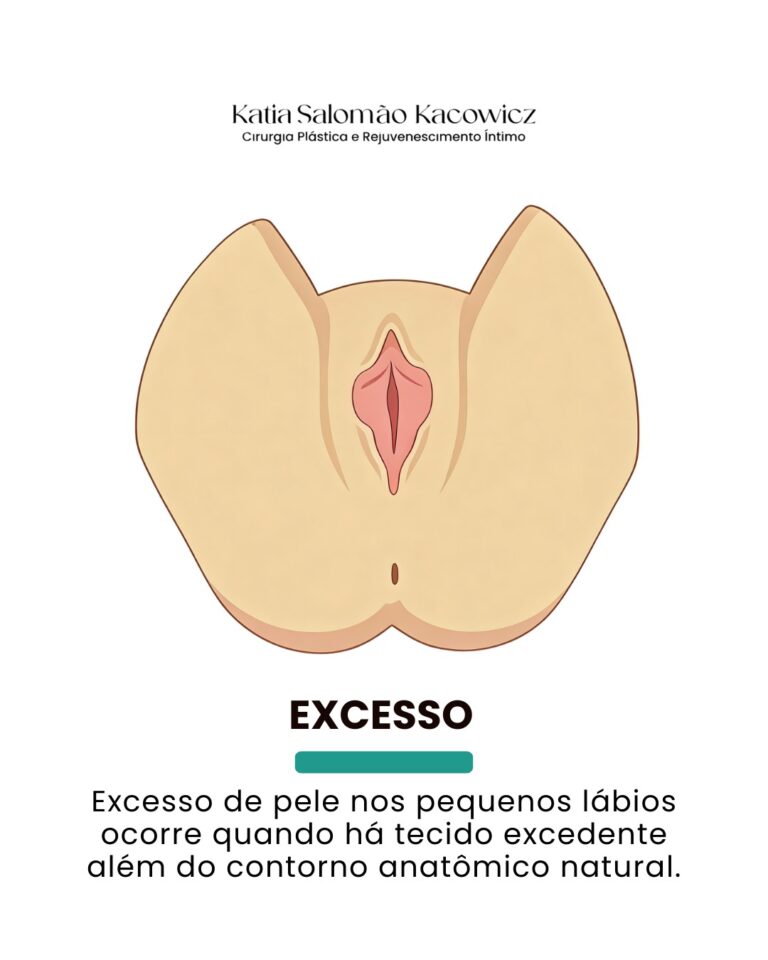Característica anatômica 3