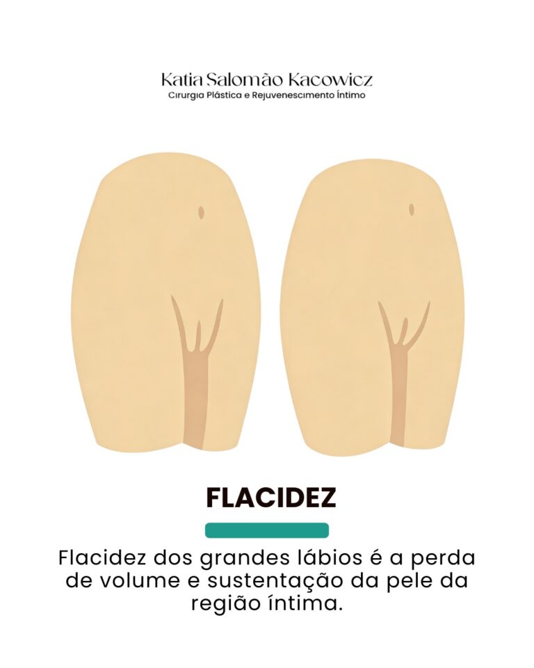 Característica anatômica 4