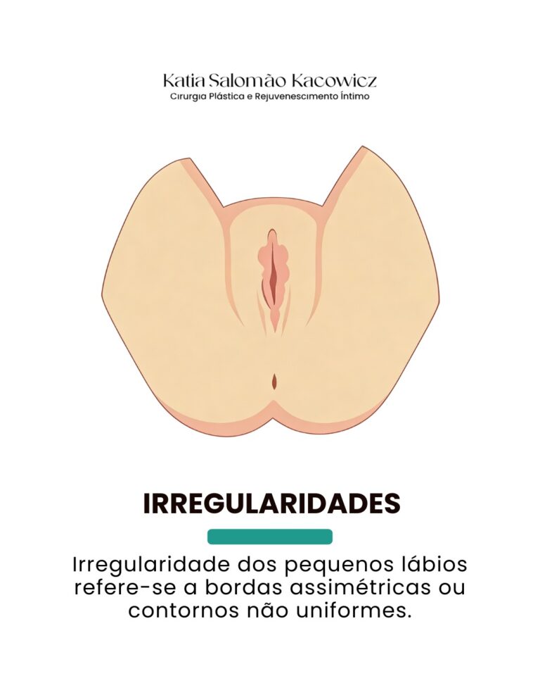 Característica anatômica 5