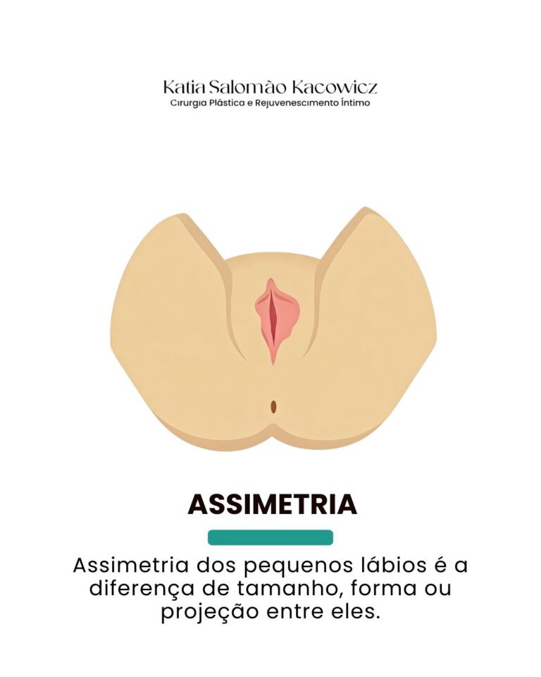 Característica anatômica 1