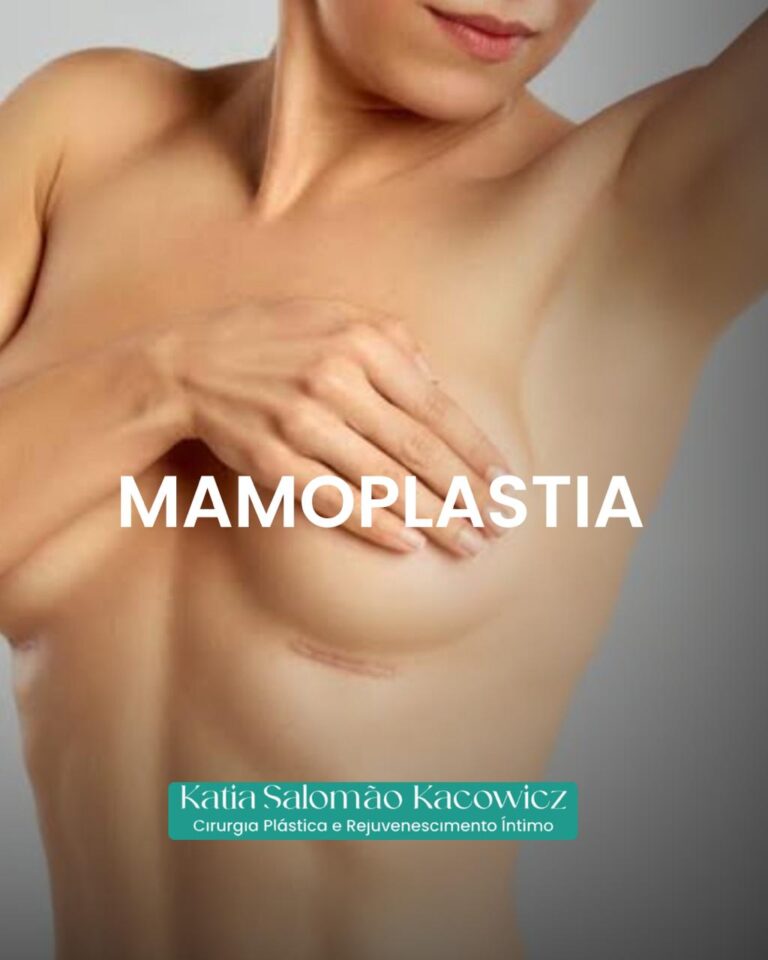 Mamoplastia
